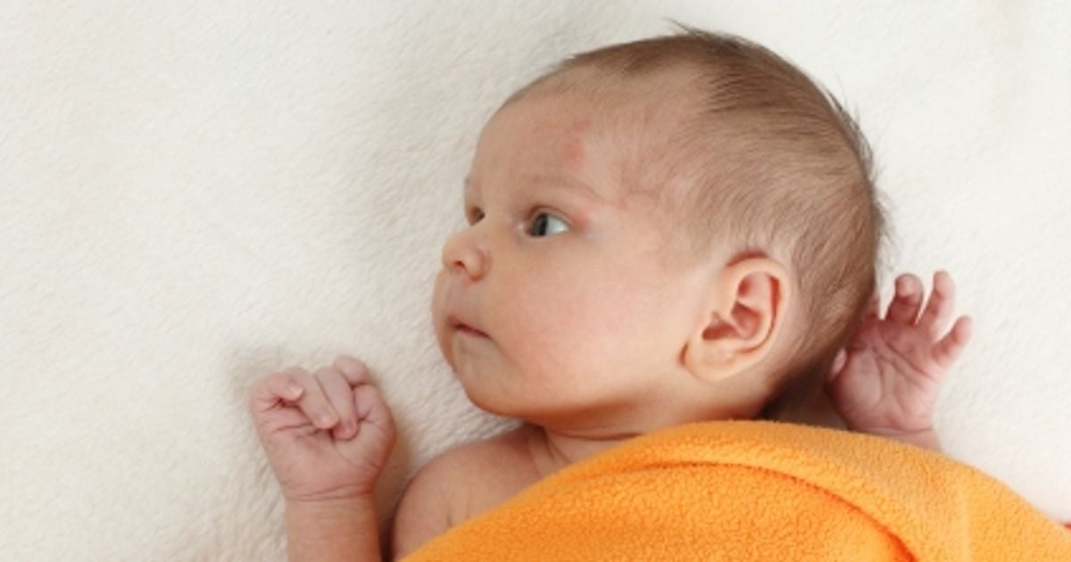 Soft spot concern Today's Parent