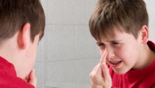 Can kids get acne?