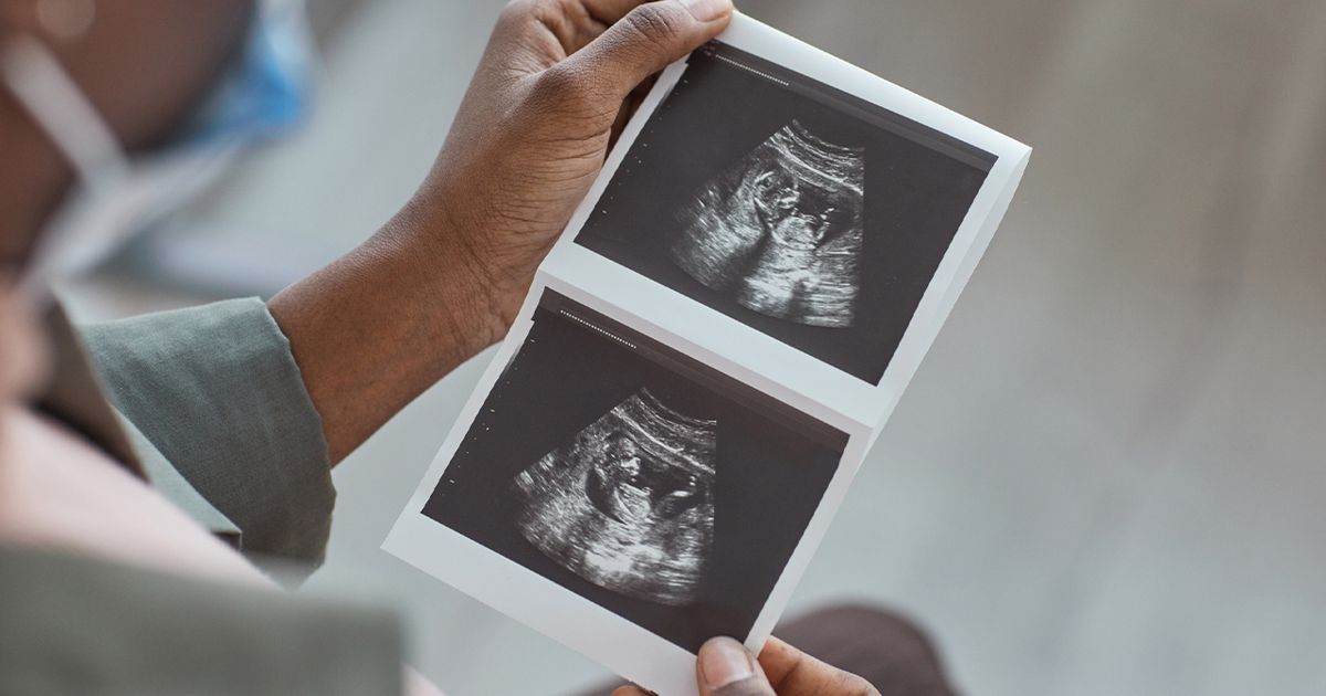 I gained 100 pounds with gestational diabetes despite throwing up a ton