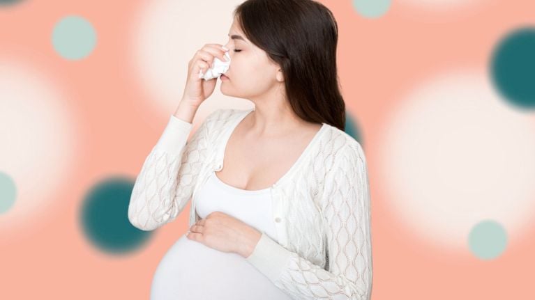 A pregnant person in a white cardigan holds a tissue to their nose against a stylized pink and teal background—highlighting the common experience of nosebleeds during pregnancy.