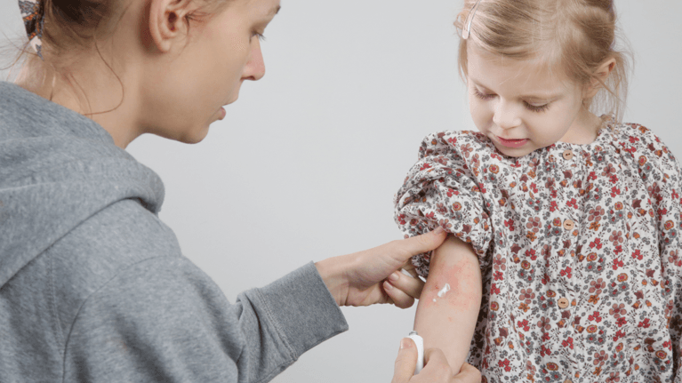 How To Spot And Care For Children’s Skin Conditions