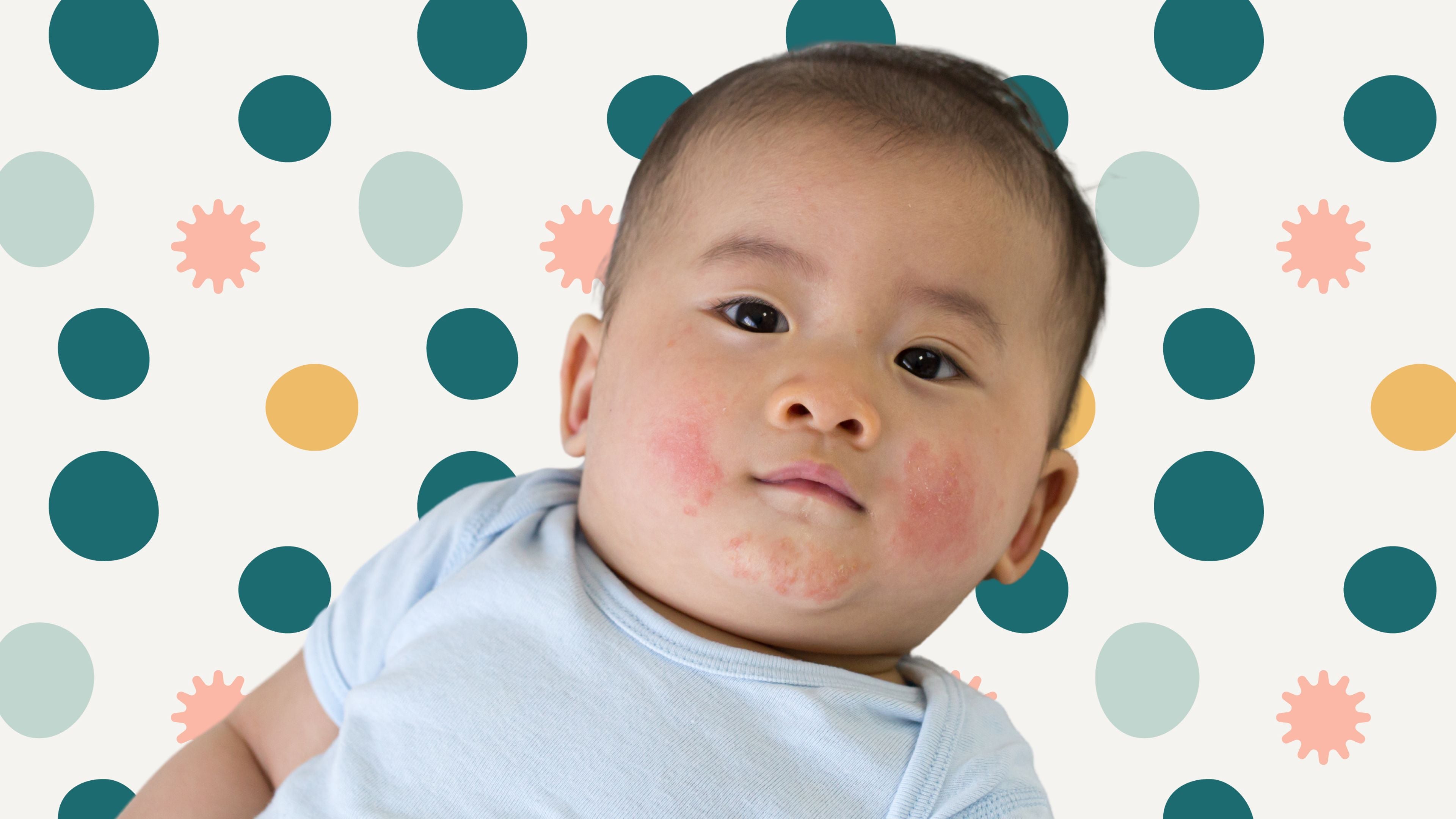 Child Fever Then Rash On Face - Infoupdate.org